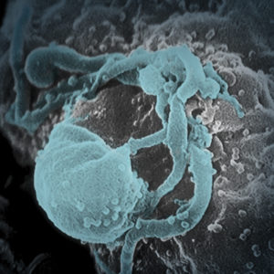 An enhanced image of a Human Immunodeficiency virus attacking a cell